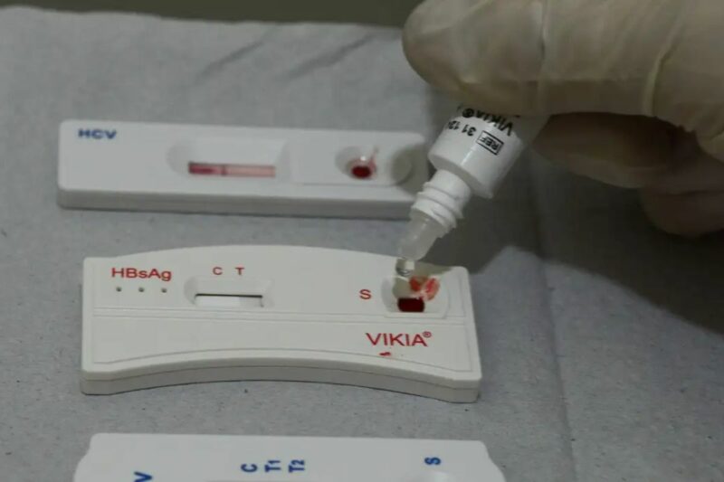 hiv-transplante-rio